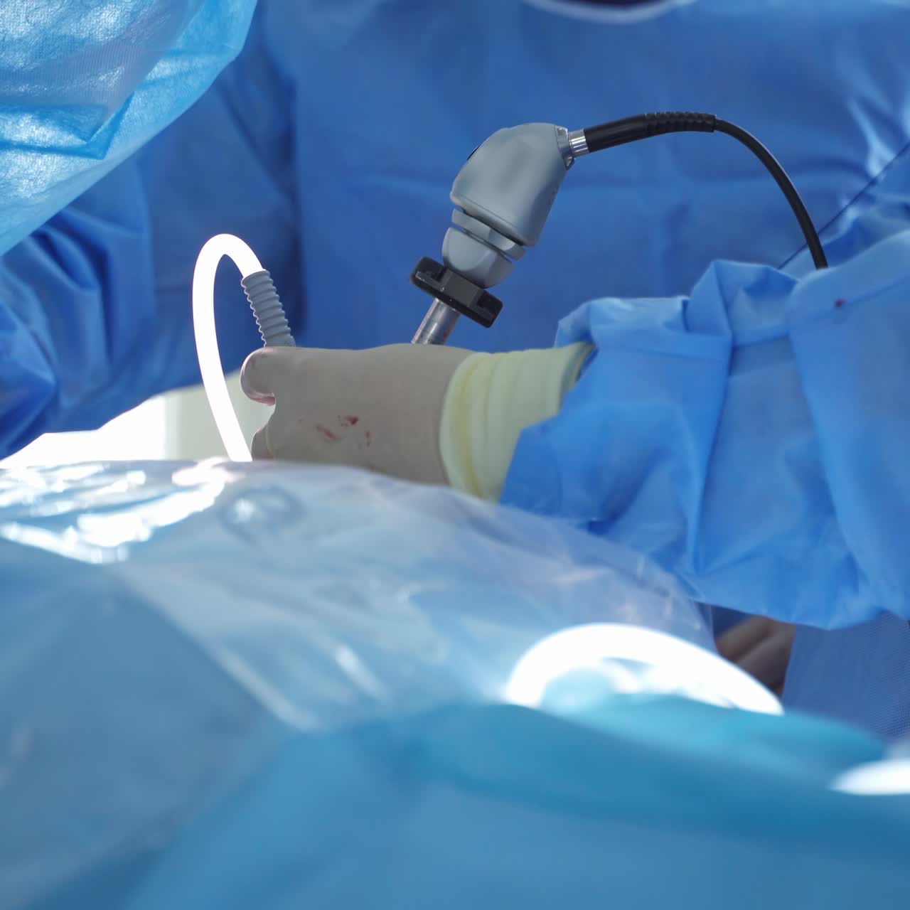 Modern equipment in operating room. Team surgeon at work in operating room. Surgeon in operating room with surgery equipment