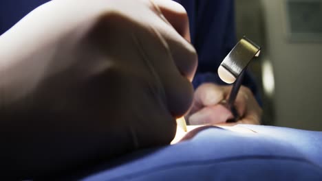 close-up of surgeons performing operation in operation room