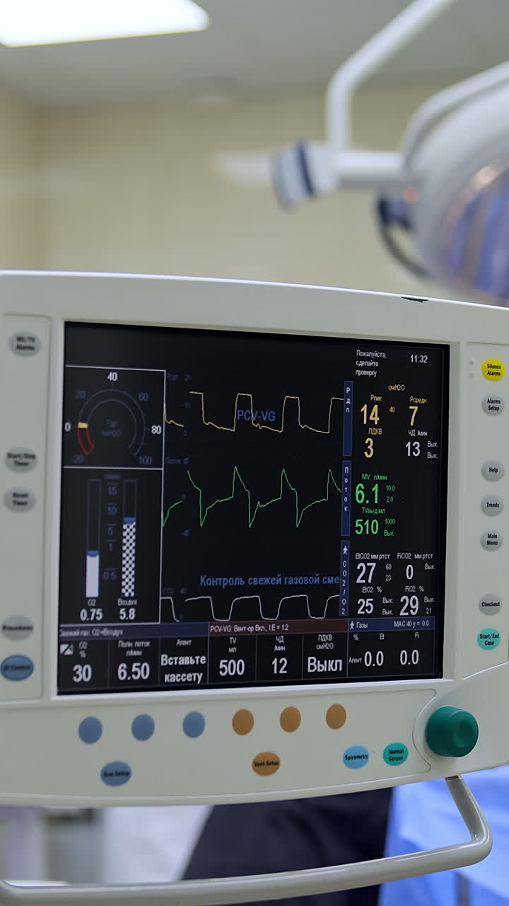 Two screens displaying the life signs of a patient. Monitors of artificial lung ventilation system working during surgery. Doctors working at backdrop. Vertical video