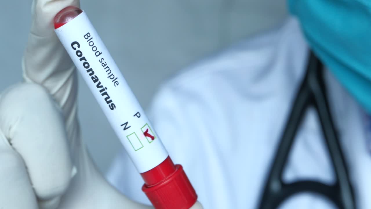 Test del campione di sangue per Coronavirus
