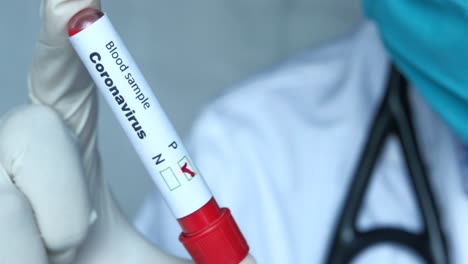 coronavirus blood sample test