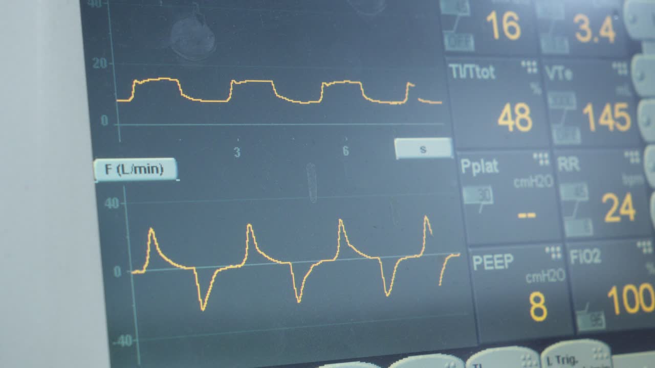 Close Shot Live Electrocardiogram Wave on Hospital Monitor Medical Checkup