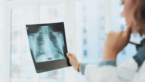 x ray, analysis and woman doctor thinking