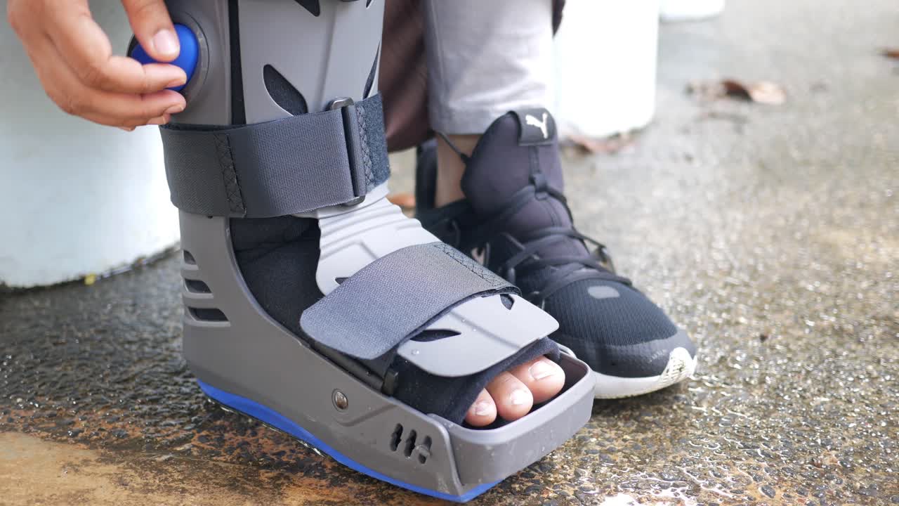 mujeres con pies rotos con una bota de plástico gris y una herida en el tobillo que protege la bota,