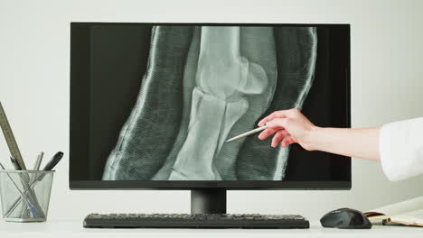 doctor reviewing knee x-ray
