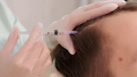 hair mesotherapy procedure in the modern cosmetology clinic. trichologist makes injections in the man’s scalp for hair growth and to prevent baldness