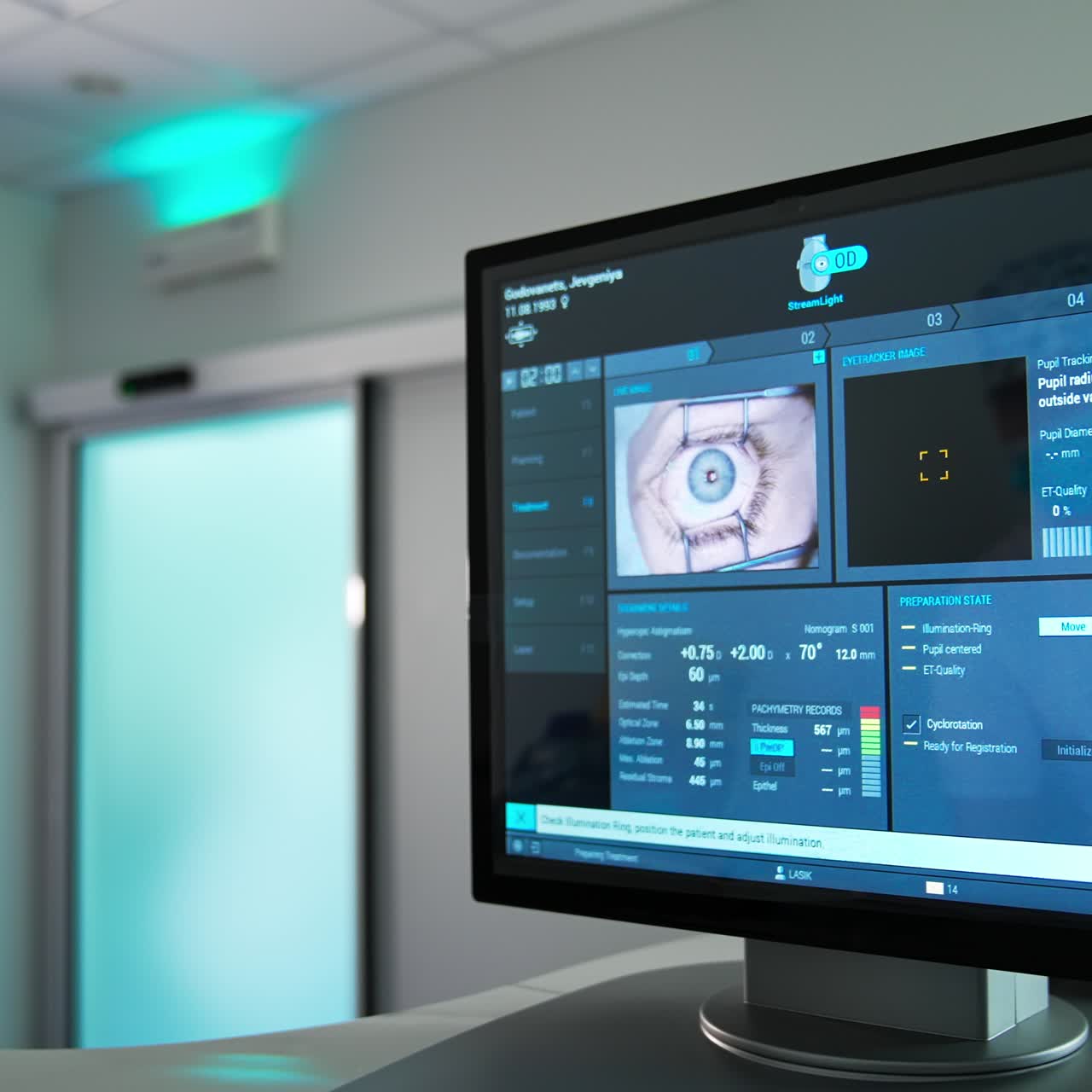 Eye laser correction monitoring. Ophtalmology laser correction