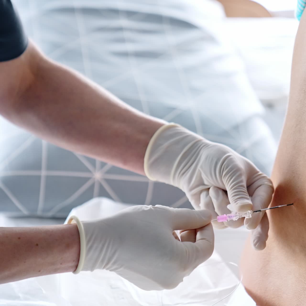 Doctor performs epidural anesthesia for a pregnant lady. Preparation for the giving birth to a child