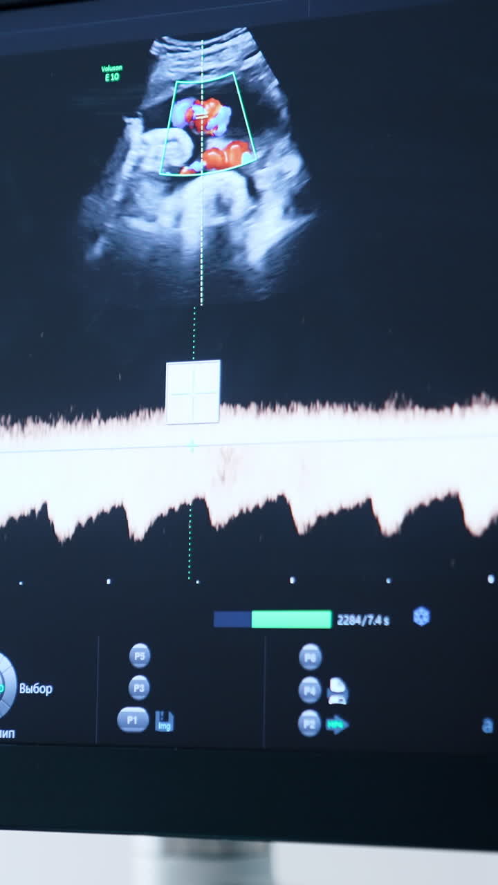 Black screen of ultrasonic equipment. Monitor showing fetal heartbeat. Close up. Vertical video