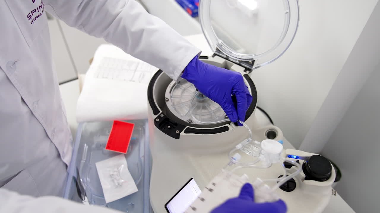 Unrecognized medic in blue gloves attaches the tube of blood transfusion system to a centrifuge machine. Preparation for plasma extraction. Top view.