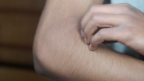 person scratching their arm