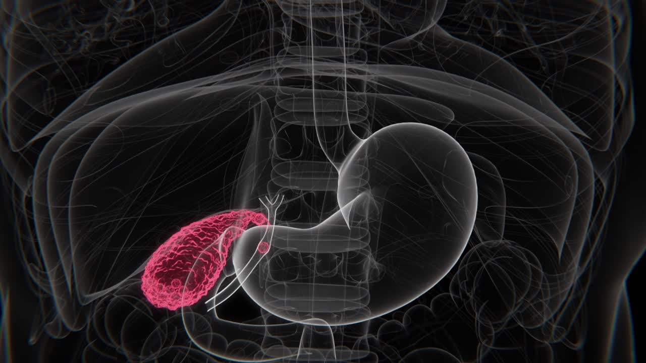 Cholecystitis Indication X-Ray Video | Gallbladder Infection indication in Vertical HD X-Ray Video