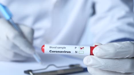 prueba de muestra de sangre de coronavirus