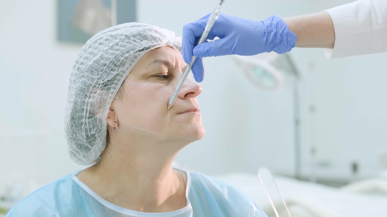 marcado antes de los procedimientos para el rejuvenecimiento de la piel de la cara. cosmetología de hardware profesional