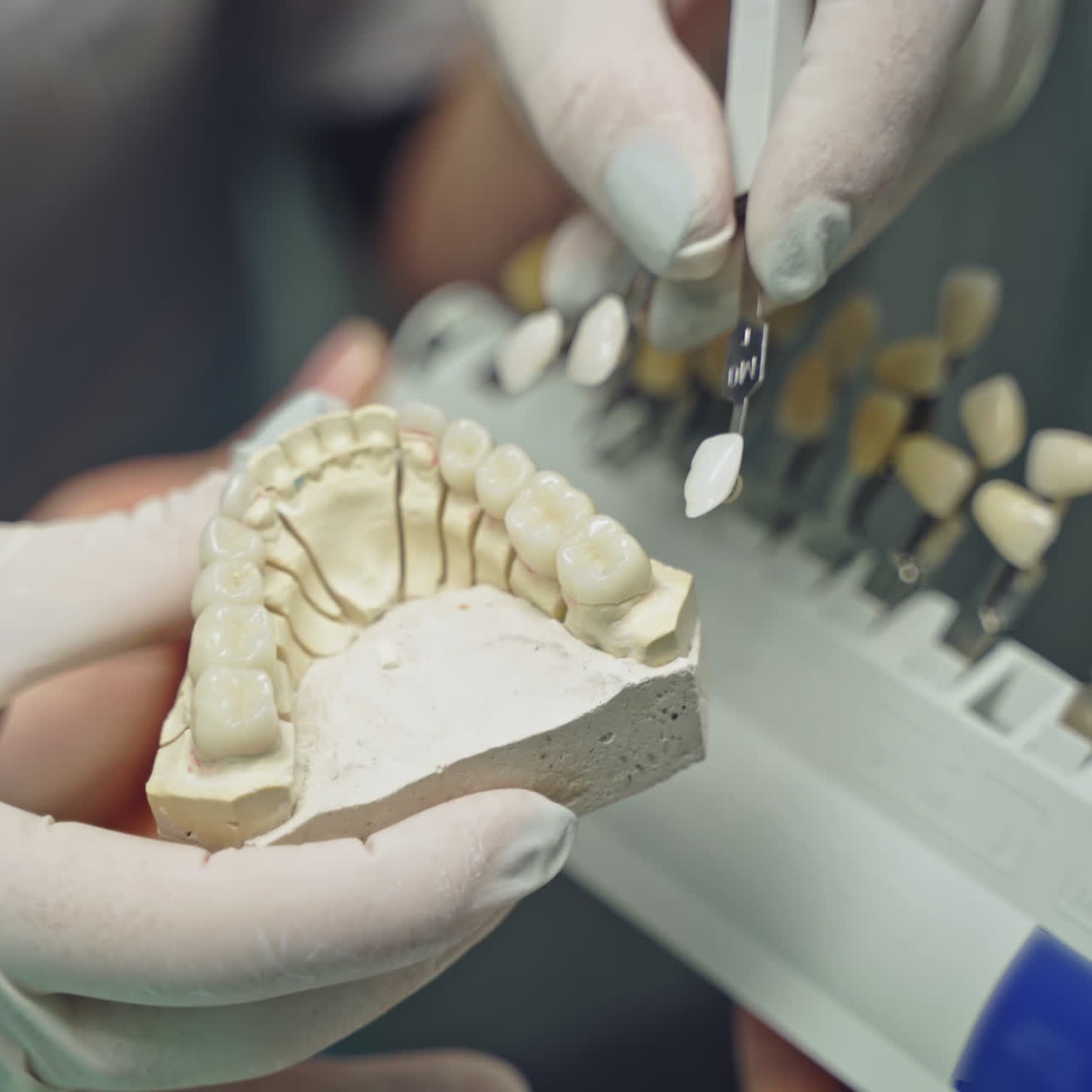A doctor in latex gloves is holding in his hand an cast of the jaw with teeth and selecting crowns with a similar shape on the blurred background. Close-up.
