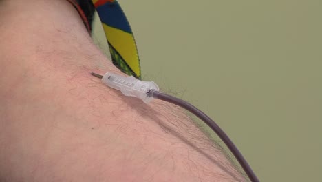 close up of a needle during blood drawing