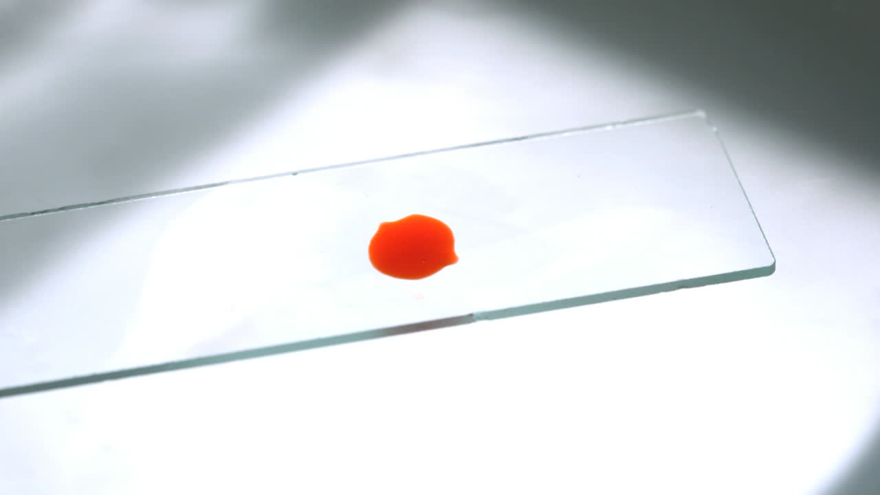 슬라이드에 떨어지는 피 한 방울