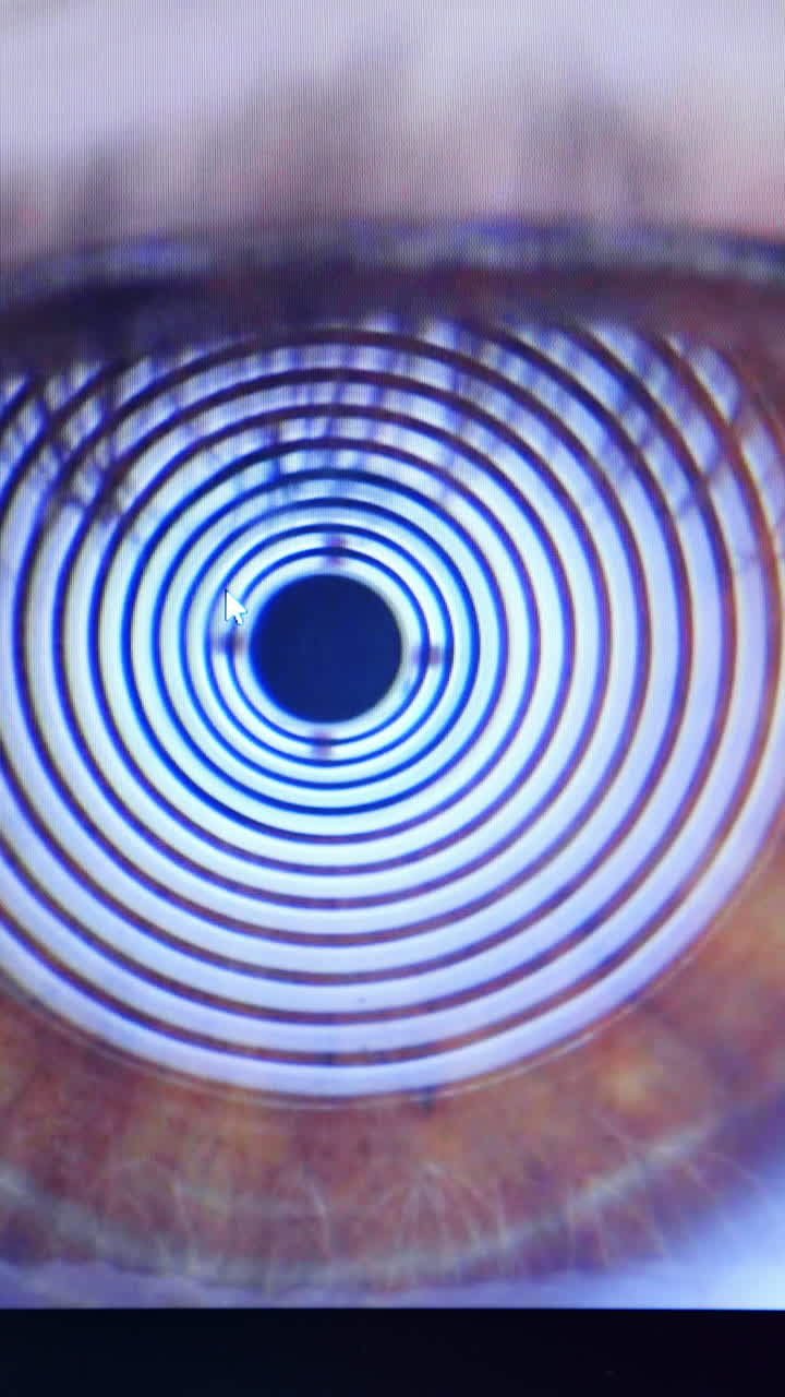 Patient's eye on screen. Computer screen showing eyeball problems. Optometrist checks vision using autorefractor. Close-up. Vertical video