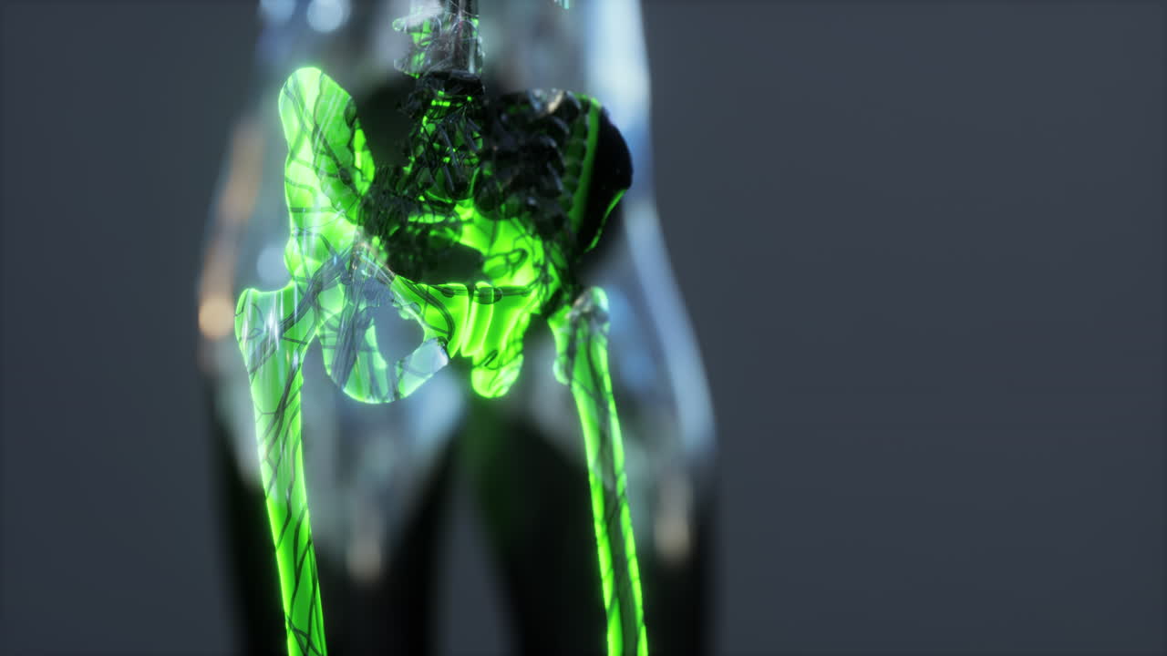 전체 골격의  ⁇ 스레이 밝기 빛