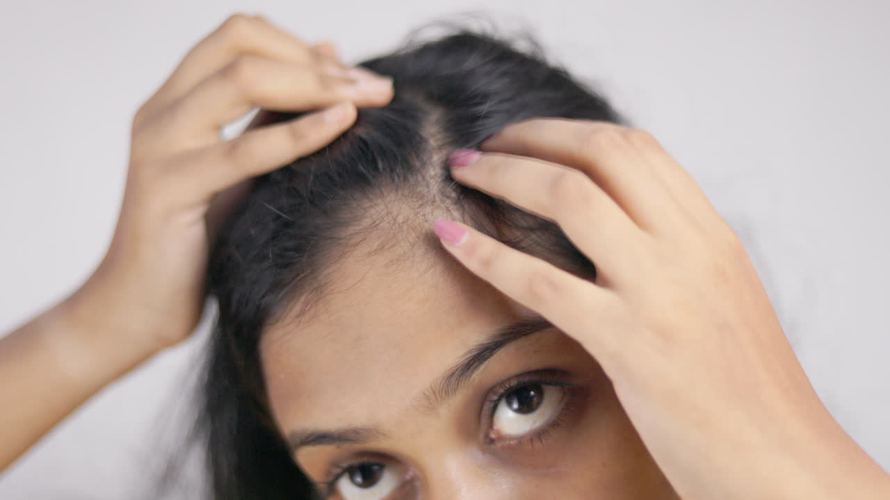 In white background a young woman suffering from hairloss showing her scalp