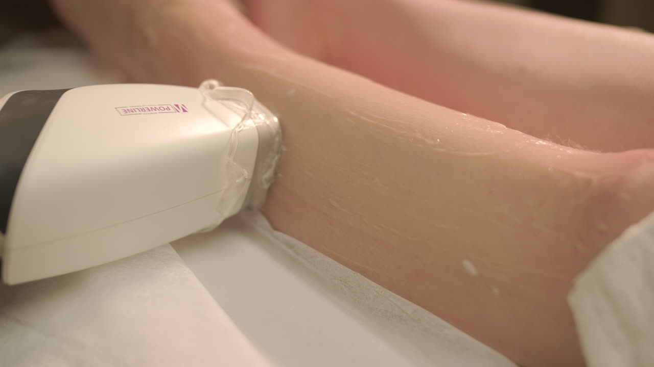 Close-up of Laser Hair Removal Procedure on Woman's Leg