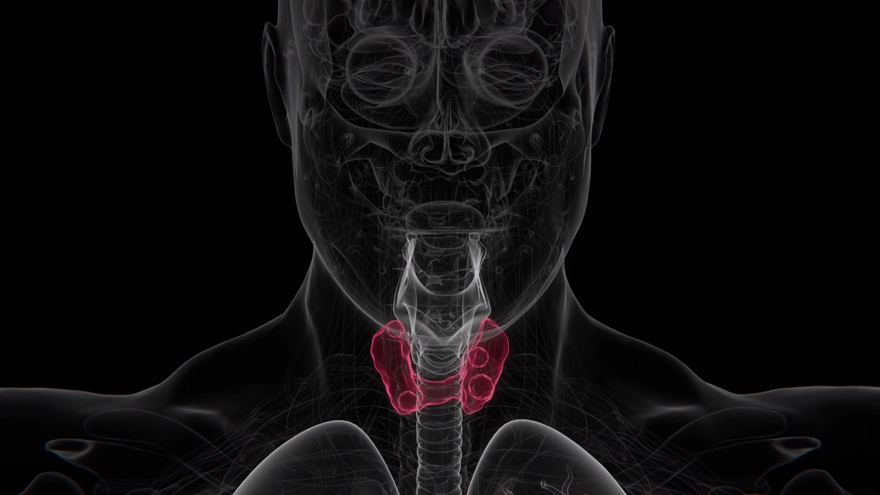 I noduli tiroidei sono masse o escrescenze anomale all'interno della ghiandola tiroidea che possono essere solide, piene di liquido o una combinazione di entrambe in video 4K UHD