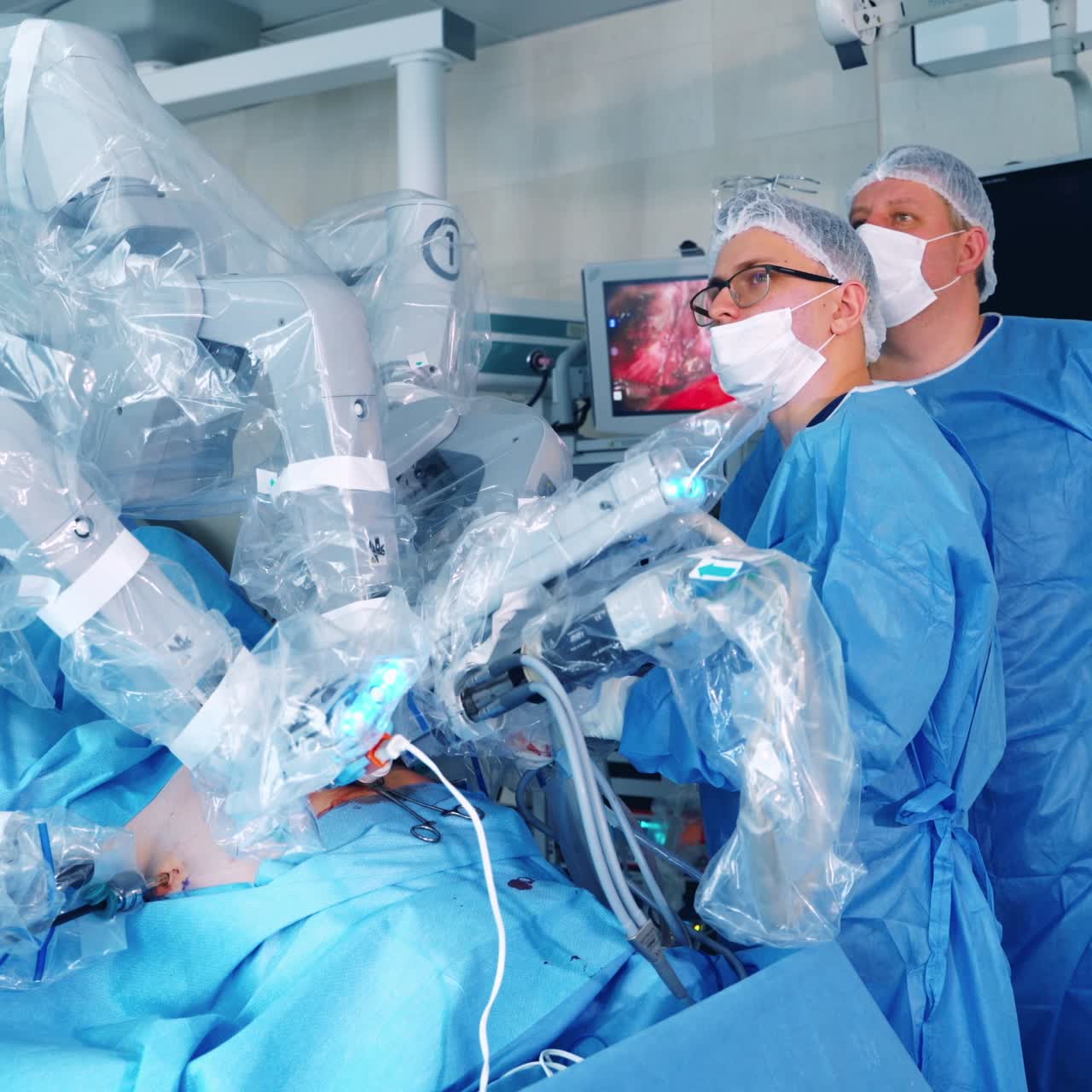 Minimally invasive robotic surgery system. Doctors in blue uniform use robotic medical equipment during surgery. Modern medical equipment in the operating room.
