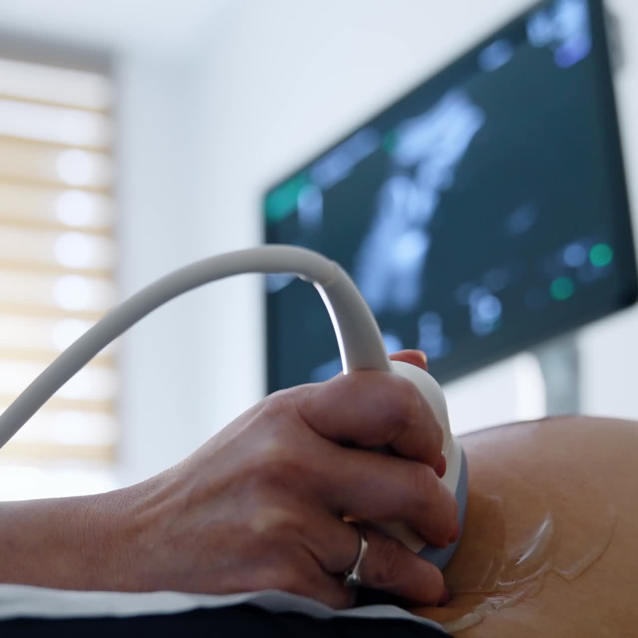 Pregnant ultrasound diagnostic. Prenatal analysis of newborn