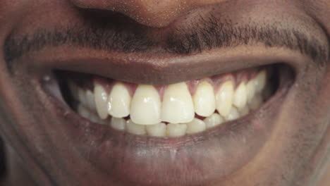 Cerrar-Los-Labios-Del-Hombre-Afroamericano-Sonriendo-Alegre-Feliz-Mostrando-Dientes-Blancos-Sanos-Concepto-De-Salud-Dental