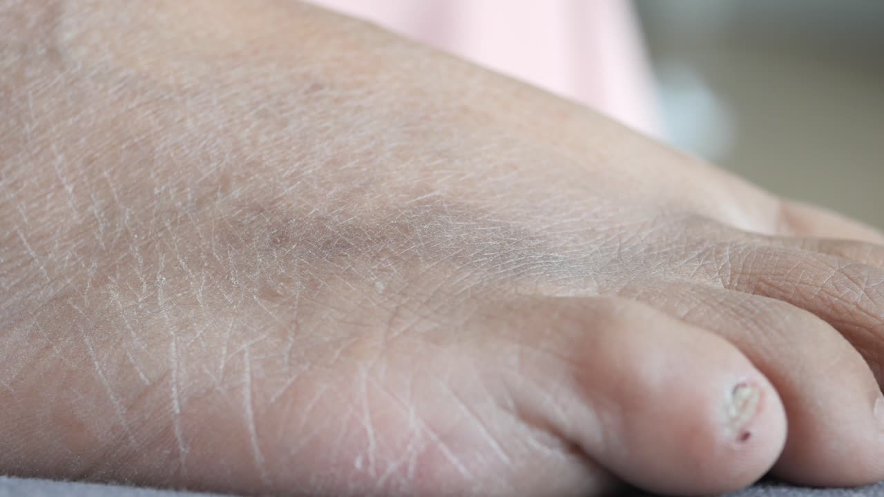 건조하고 은 발