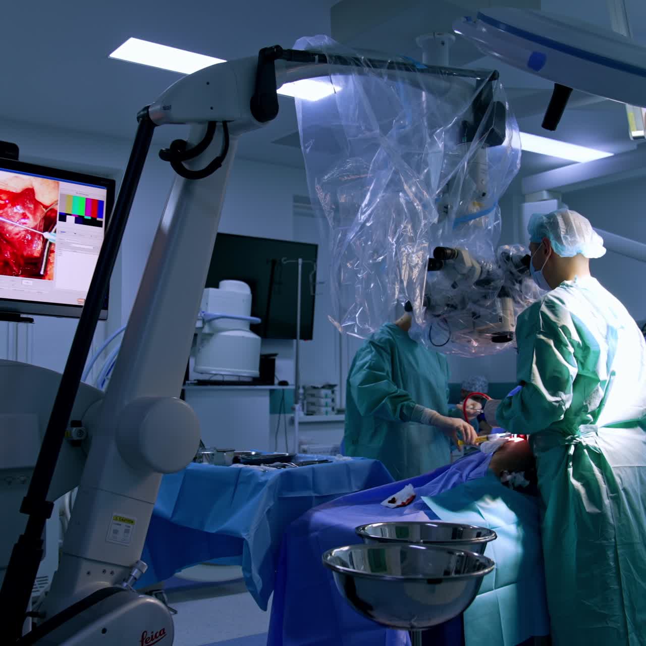 Surgical operation conducted with the help of modern microscope. Neurosurgeon uses instruments and nurse passes the tools