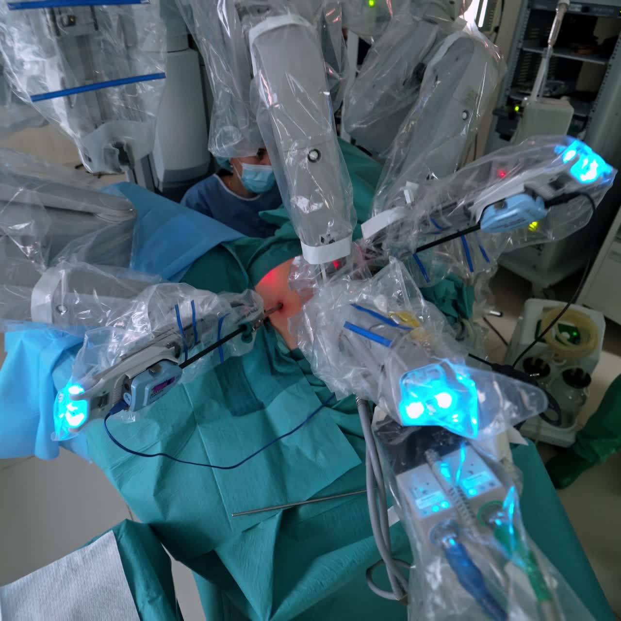 Robotic technology equipment in clinic. Minimally invasive surgery in the operating room in hospital. Medical specialists control the work of robotic machine. Top view.