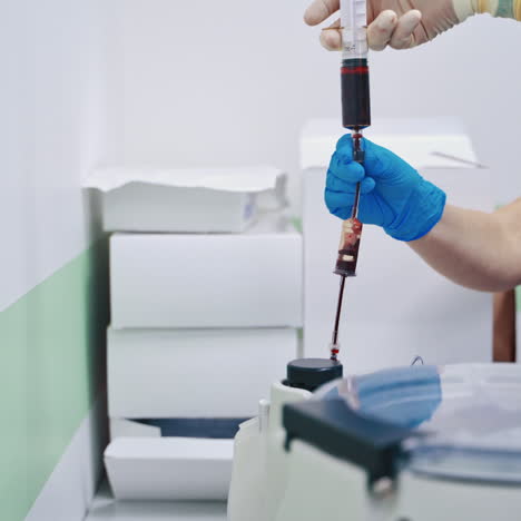 stem cells procedure. laboratory workers pouring blood into modern machine. new equipment for testing blood samples.