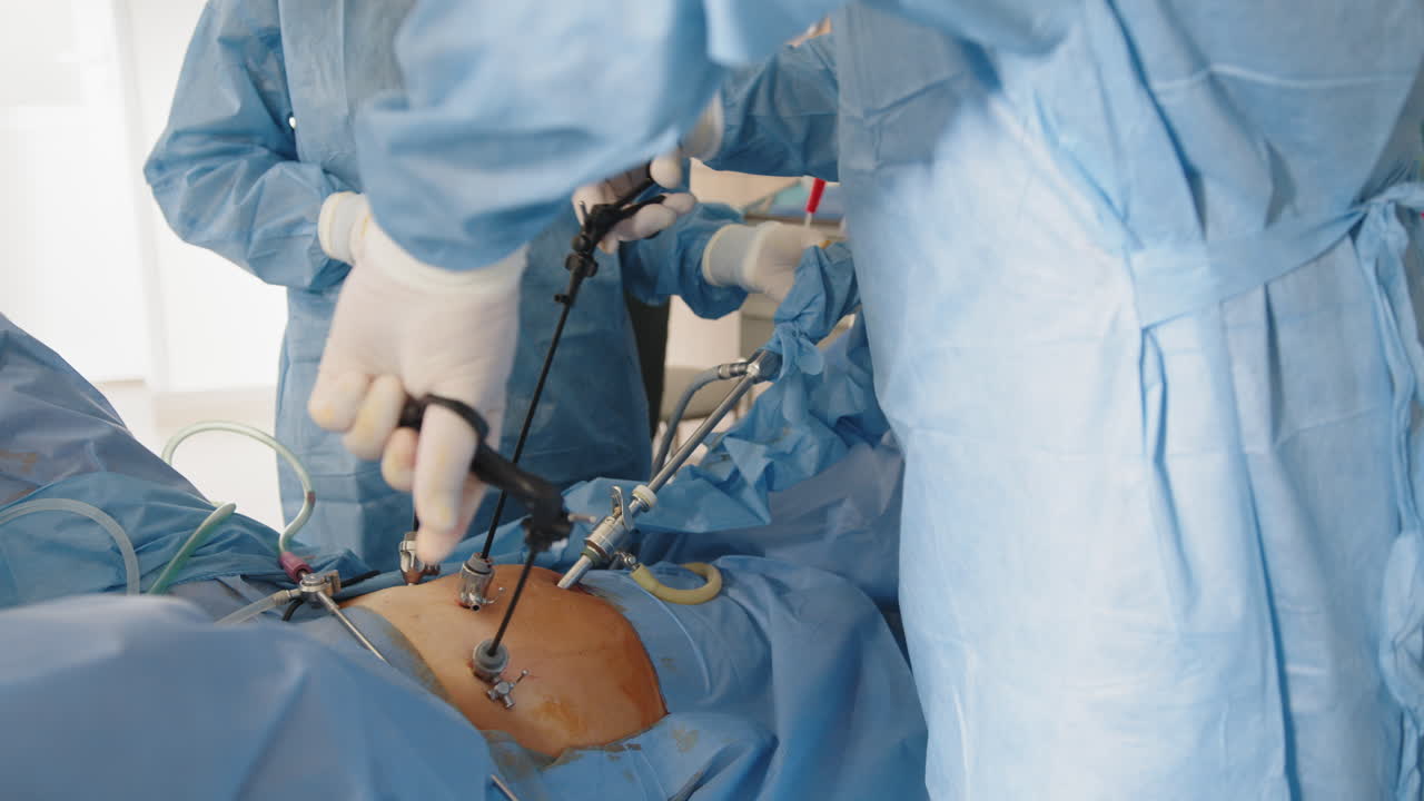 cirugía abdominal laparoscópica