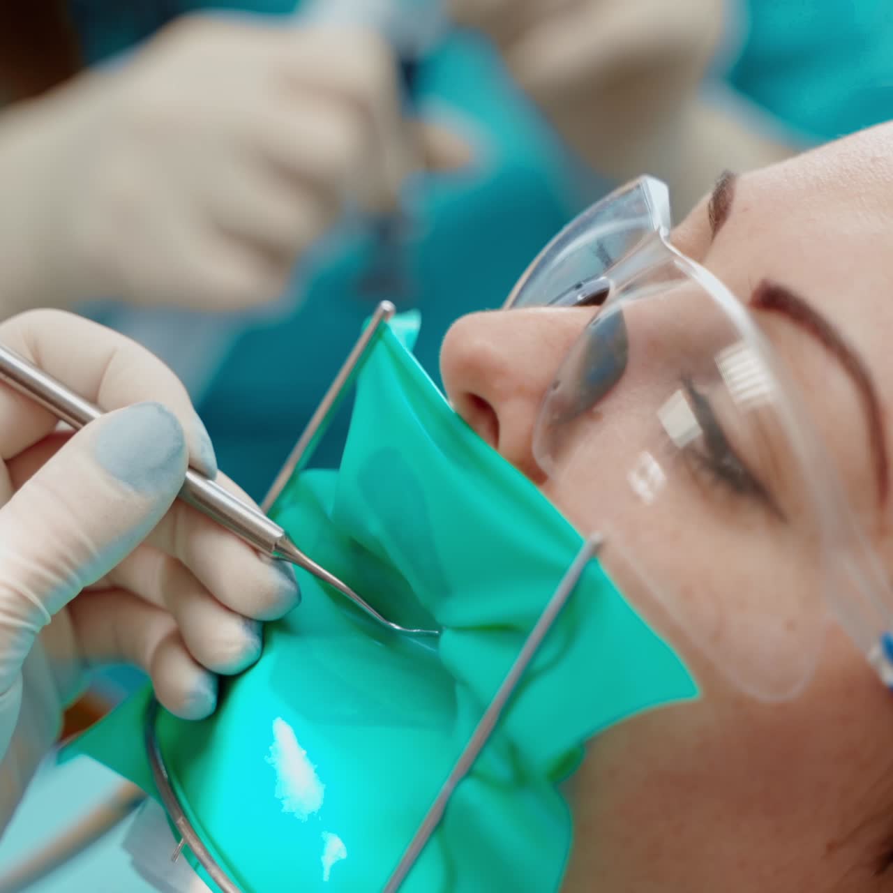 Female patient's face during tooth treatment. Young woman in protective glassses and mask in stomatology clinic. Dentist in gloves treats teeth. Close-up.