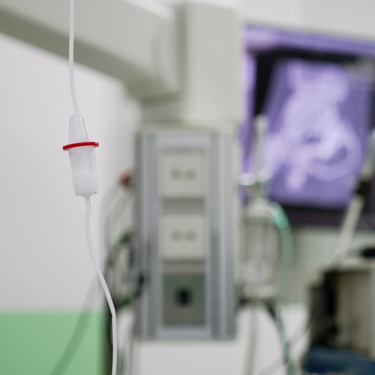 Serbatoio contagocce con medicinale bianco all'interno. Primo piano. Attrezzatura medica in sala operatoria. Sfondo sfocato.