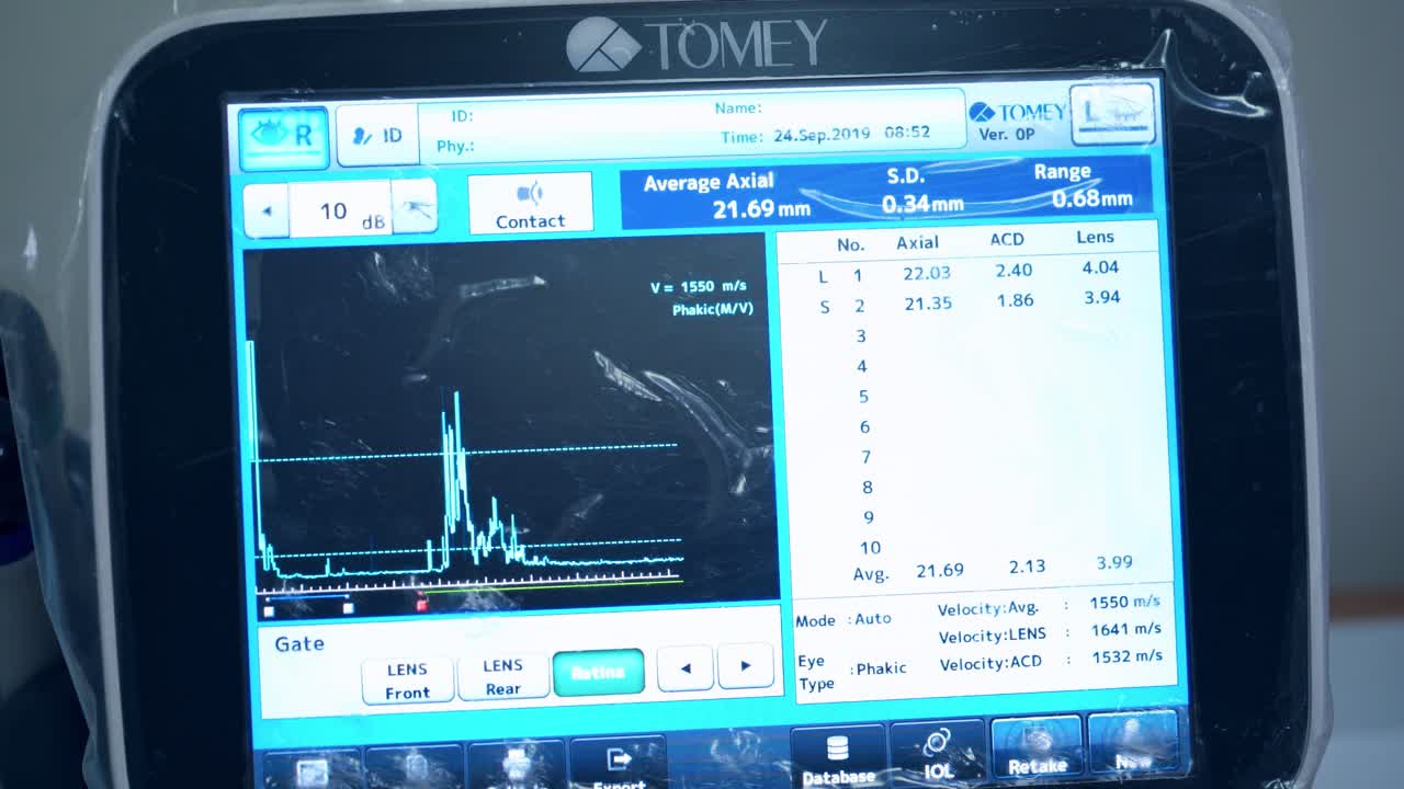 Diagnostic ophthalmologic equipment. Doctor controls the oculist display with scanned eye