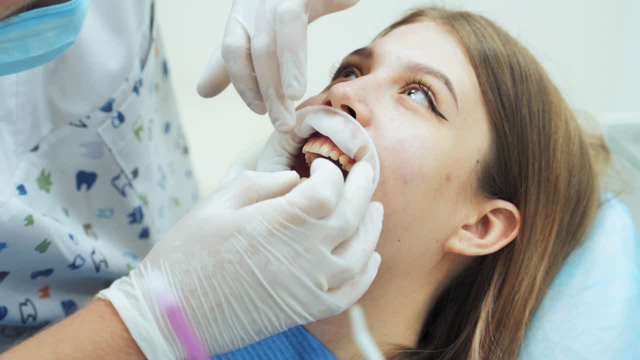A male dentist in medical white latex gloves puts rubber dam on a patient girl in a dental clinic