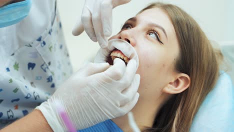 a male dentist in medical white latex gloves puts rubber dam on a patient girl in a dental clinic