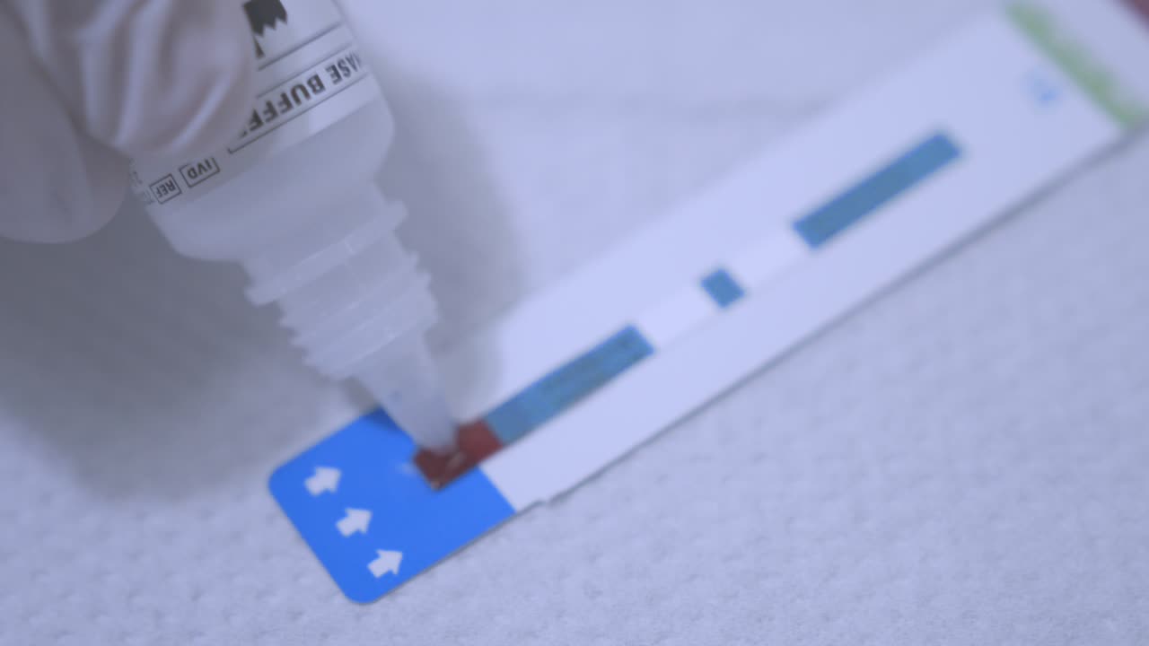 Drop reagent on test strip. Blood hiv test strip. Hiv blood test