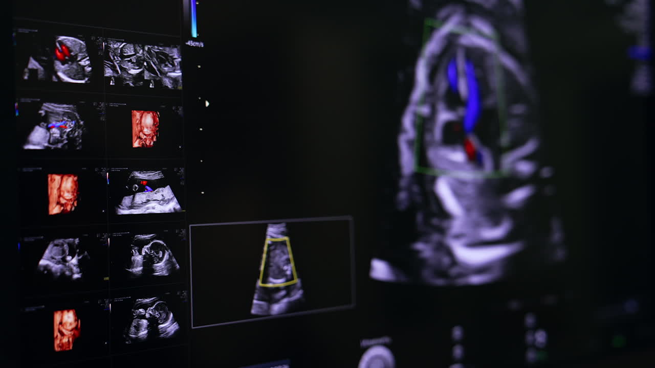 Yet unborn child on the ultrasound machine screen. Baby development examination on modern equipment.