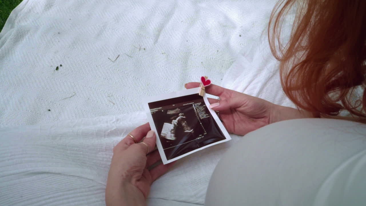 Immagine ecografica nelle mani di una donna su sfondo di tessuto bianco.