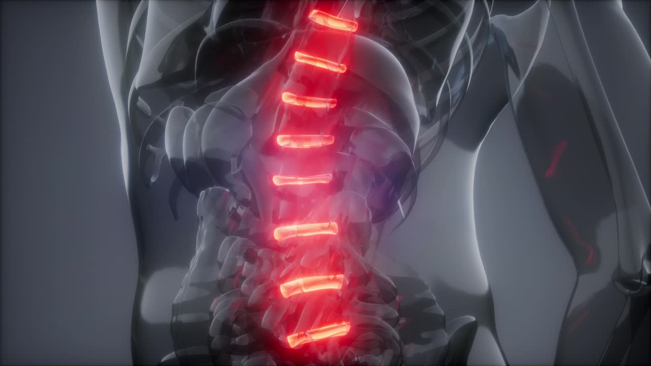 허리  ⁇ 에 허리 통증