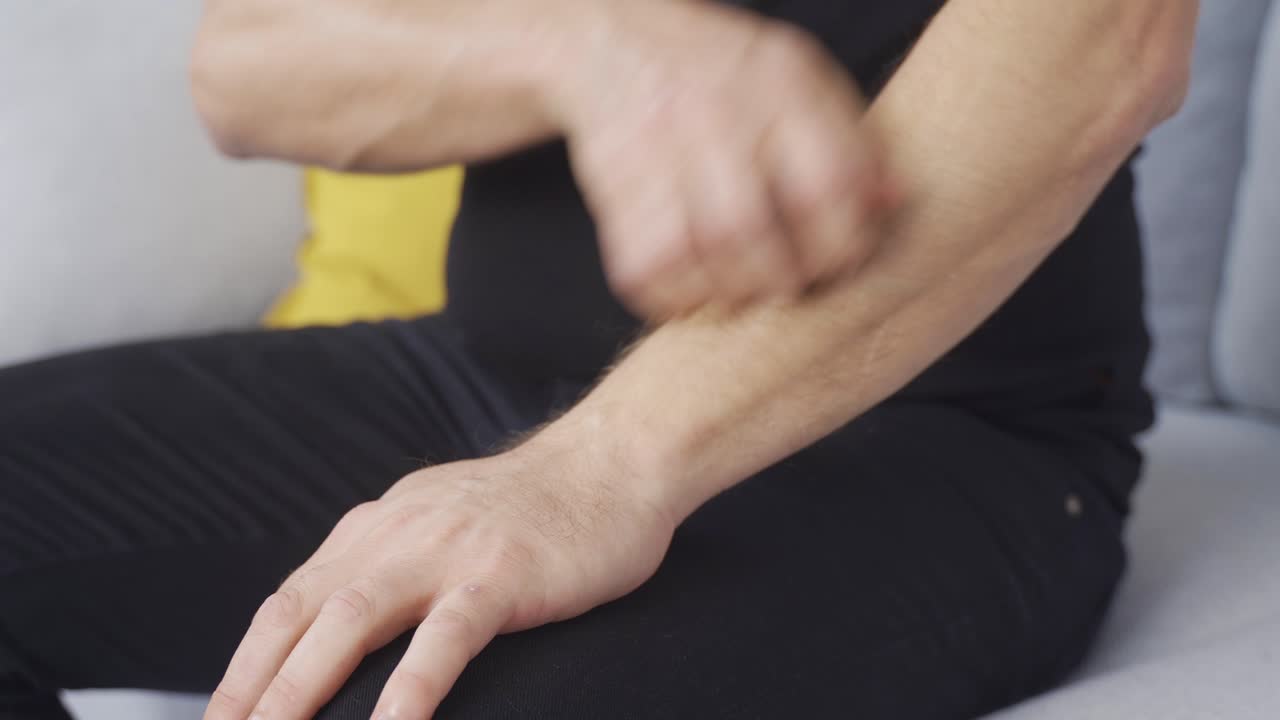 Allergy man scratching his hands. Irritated hands.
