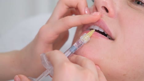 lip injection procedure