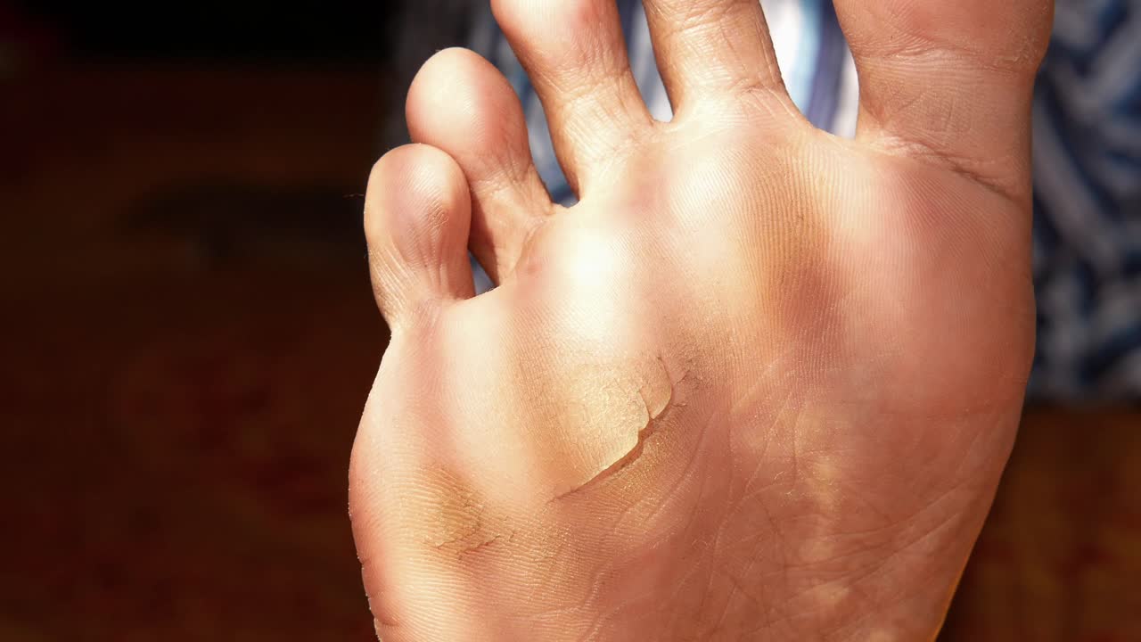 은 피부가 있는 발의 근접한 모습