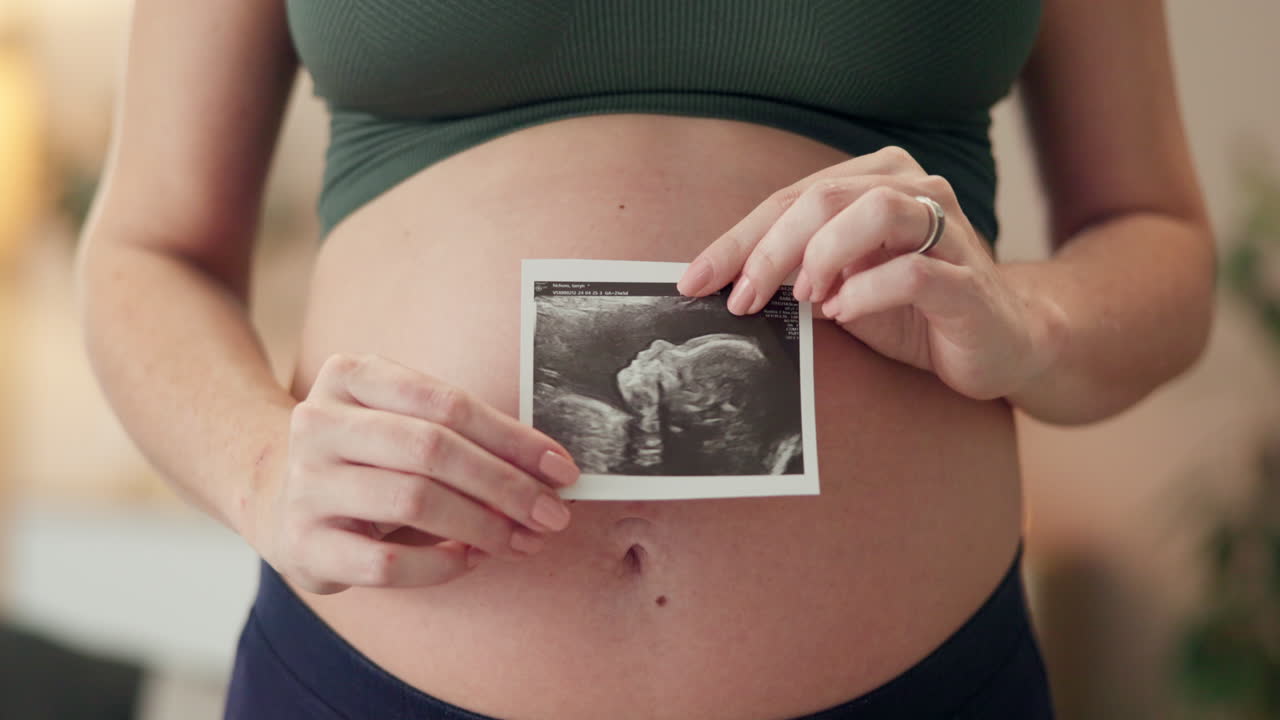 mujer embarazada con una imagen de ultrasonido