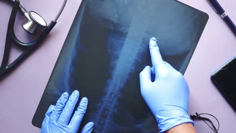 doctor hold analyzing xray photography closeup