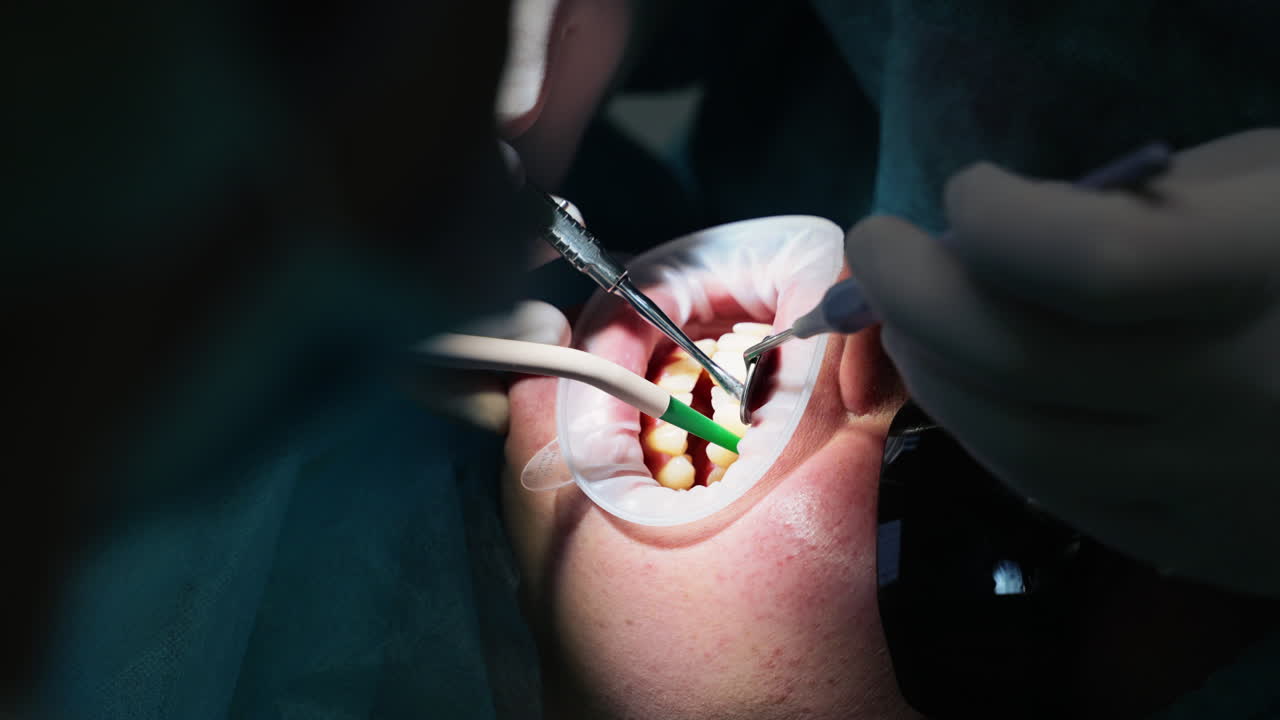 Cleaning and treatment of teeth with medical instruments in a dental clinic. Close-up. Dental lip retractor. Doctor's hands in latex gloves