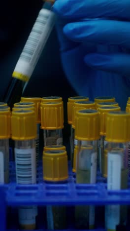 recogida de muestras de sangre en un laboratorio